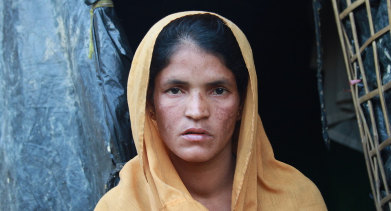 Shawkat - Rohingya refugee camp - Bangladesh 2017 2