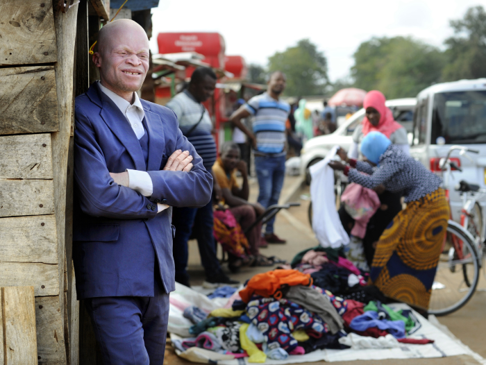Malawi 2022 People With Albinism Baison Makolopa banner image