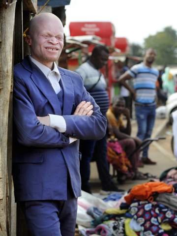 Malawi 2022 People With Albinism Baison Makolopa banner image