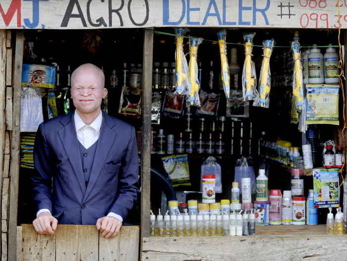 Malawi 2022 People With Albinism Baison Makolopa 01